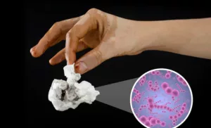 rickettsial disease