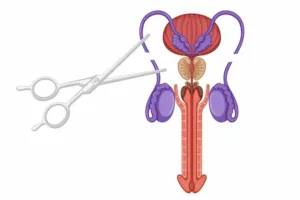What Is A Ddl Surgery