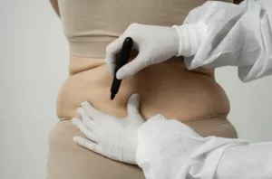 Zion Plastic Surgery
